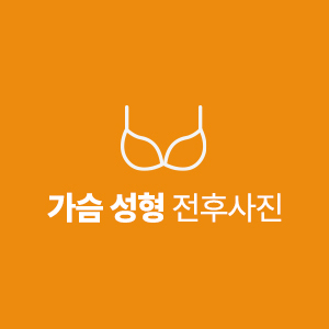 가슴성형 전후사진