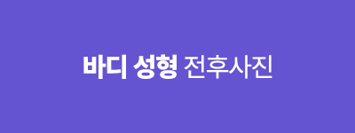 바디성형 전후사진